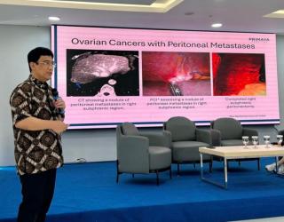 Kabar Baik! Pasien Kanker Kini Bisa Dapat Terapi Kelas Dunia di Indonesia