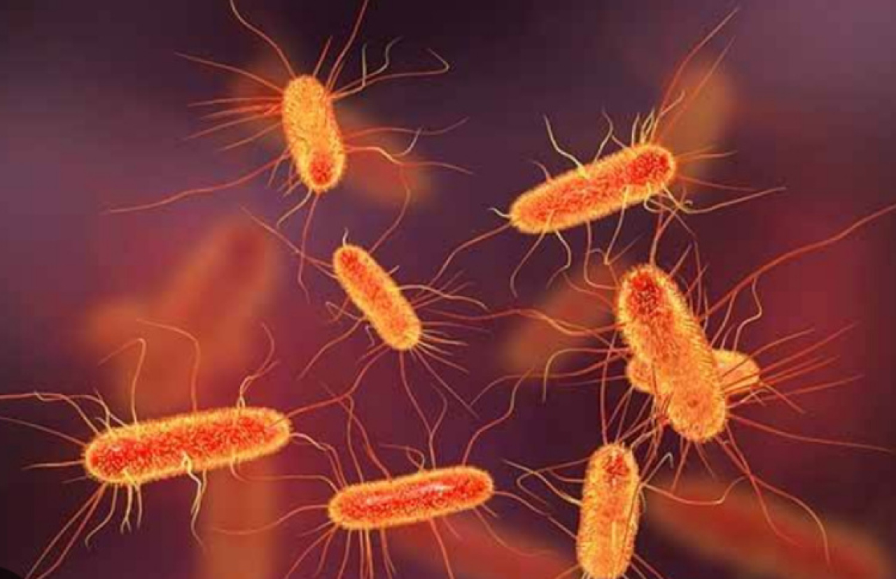 Pemeriksaan laboratorium dilaporkan menemukan bakteri Escherichia coli (E. coli) dalam sampel air.